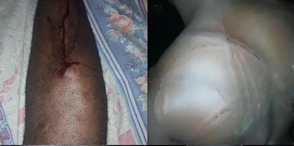 Soldiers Allegedly Brutalize Man For Wearing A Fitted To In Lagos